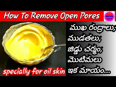 How To Remove Open Pores In Telugu /Beauty Tips In Telugu /How To Get Glowing Skin Naturally At Home