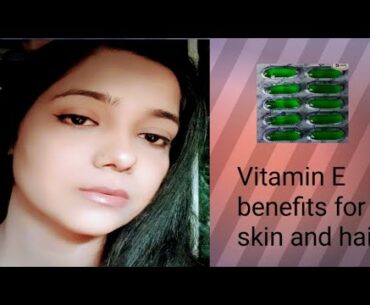 Benefits n uses of vitamin e capsules/vitamin e for skin and hair/ problem free skin and hair