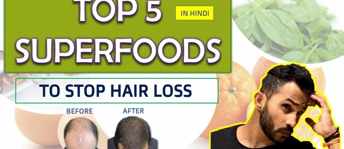 Top 5 Foods For Healthy Hair Hindi | Superfoods - E1| Fitness My Life