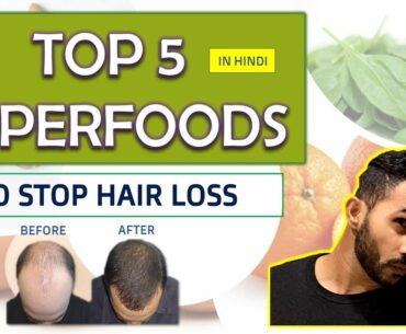 Top 5 Foods For Healthy Hair Hindi | Superfoods - E1| Fitness My Life