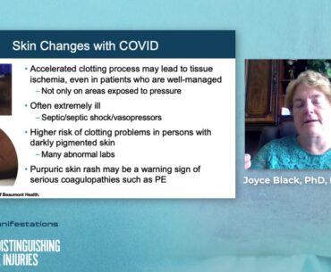 Cutaneous Manifestations of COVID-19: Identifying and Distinguishing from Pressure Injuries