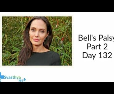 Bell’s Palsy Part 2  I Day-132