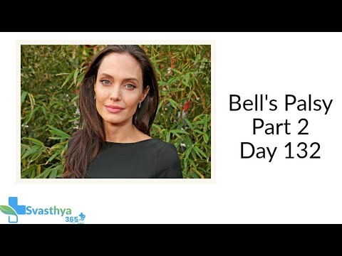 Bell’s Palsy Part 2  I Day-132