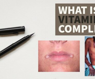 WHAT IS VITAMIN B COMPLEX ? | BIO CHEMISTRY | NUTRITION | ANYTIME MEDICINE