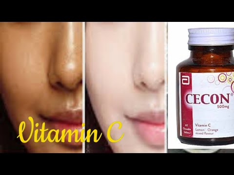 Dr Muskan| Whitening and Glowing Skin Secret| Vitamin C| My Review| Cecon Tablet Uses|