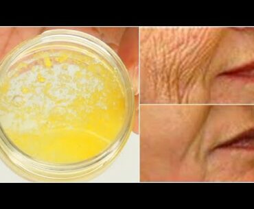 REMOVE WRINKLES FROM FACE NATURALLY AT HOME USING COCONUT AND VITAMIN E OIL, FACE MOISTURIZER