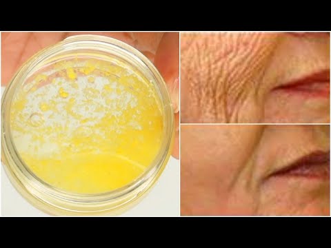 REMOVE WRINKLES FROM FACE NATURALLY AT HOME USING COCONUT AND VITAMIN E OIL, FACE MOISTURIZER