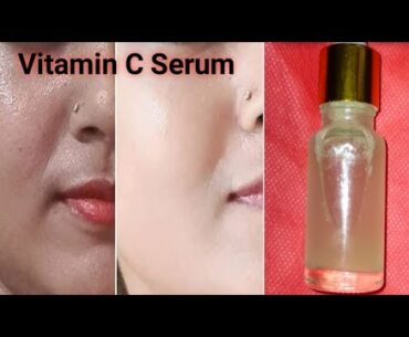 DIY Vitamin C face Serum in hindi, HOW To Make VITAMIN C SERUM AT Home , lightening whitening skin