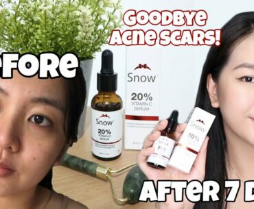 Effective na Acne Scar remover?! | Results after a week | Snow 20% Vitamin C Serum