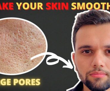 HOW TO GET RID OF LARGE OPEN PORES | SHRINK LARGE PORES | HINDI | MakePresentable