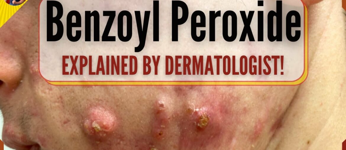 How To Use Benzoyl Peroxide Gel For Acne (Benzac) - Dermatologist explains