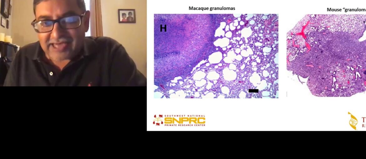 BD FACSMatters Ask the Expert: Understanding COVID-19 and Immune Responses