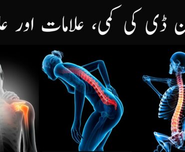 Vitamin D deficiency symptoms and prevention| Vitamin D ki kami ki alamaat aur ilaj