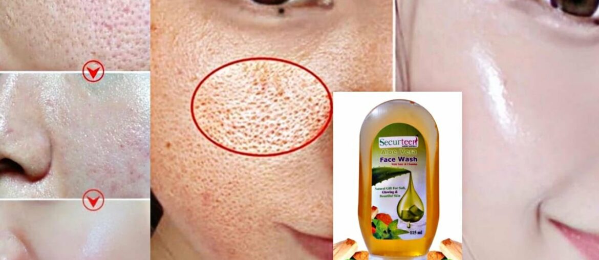 Treasure herbs Vitamin C Face wash | Anti Aging, Acne & pimples, Marks & Scars and Skin whitening?