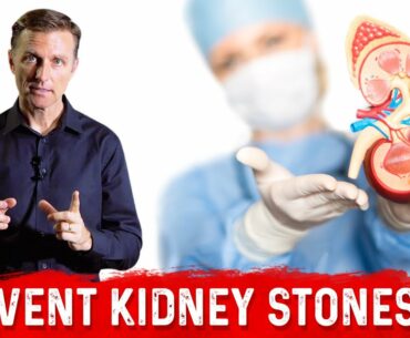 Use Vitamin A for Kidney Stones