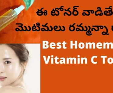 I Used This Toner On My Face Results Are Unbeleivable | Vitamin C Toner To Remove Pimples,Dark Spots