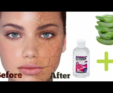 how to use aloe Vera gel and vitamin e capsules for dry skin