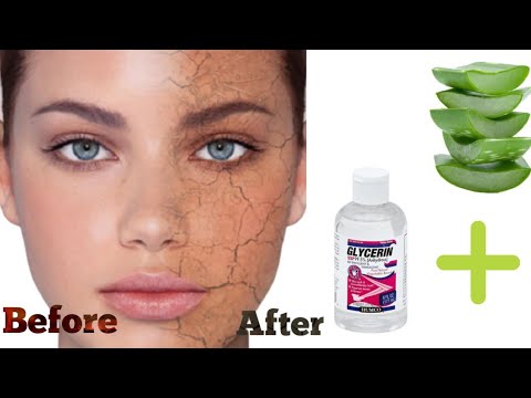 how to use aloe Vera gel and vitamin e capsules for dry skin