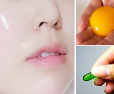 Remove Wrinkles From Face Naturally at Home / Get Rid of Deep Mouth Wrinkles using Vitamin E and Egg