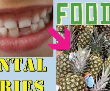 Dental Caries Foods. Vitamins, Green Tea, Fatty Fish, Milk, Fruits, Apples, Pears, Celery & Kale.
