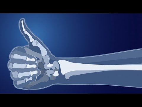 IZUMI HEALTH TALK: BONE HEALTH