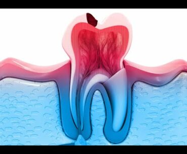 Gforce Teeth - G-Force Teeth Supplement: Advanced Dental Health Formula For Oral Care