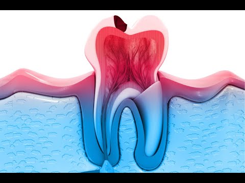 Gforce Teeth - G-Force Teeth Supplement: Advanced Dental Health Formula For Oral Care
