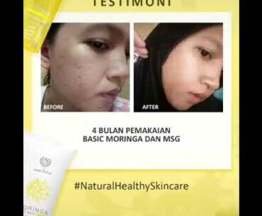 Testimoni Skincare Cream Moisturizer Pelembab Serum Anti Aging Wajah Glowing Moringa Series