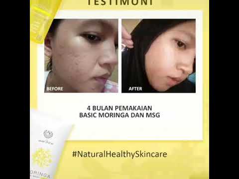 Testimoni Skincare Cream Moisturizer Pelembab Serum Anti Aging Wajah Glowing Moringa Series