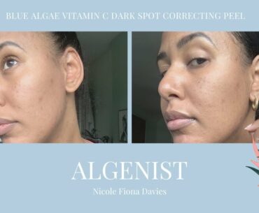 Algenist Blue Algae Vitamin C Dark Spot Correcting Peel | * REAL RESULTS * | Med - Dark Skin