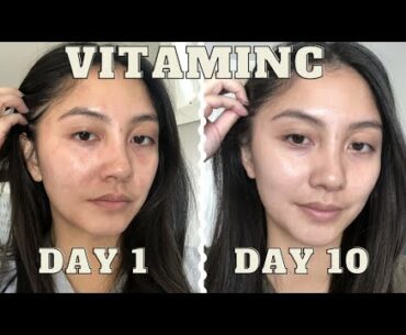 adding VITAMIN C serum to my skincare routine for 10 days | Vichy LiftActiv before & after
