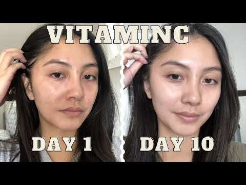 adding VITAMIN C serum to my skincare routine for 10 days | Vichy LiftActiv before & after