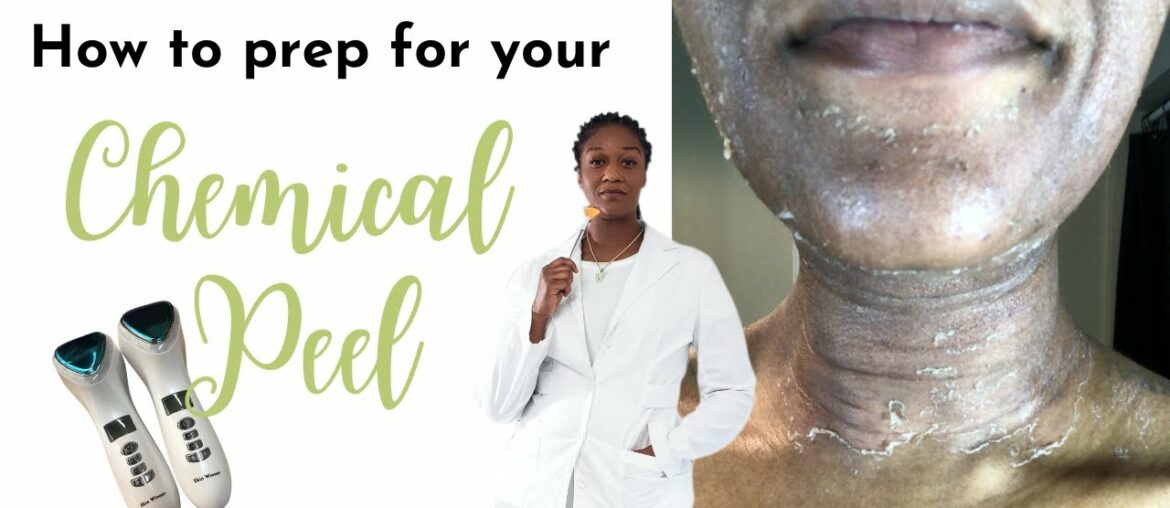 How to prep for a chemical peel | Esthetician Chemical Peel Pre Care |
