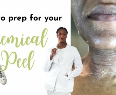 How to prep for a chemical peel | Esthetician Chemical Peel Pre Care |