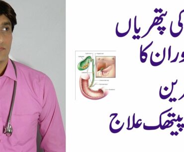 Gall Stones And its Homeopathic Treatment in urdu in hindi | Dr Faisal Afaq