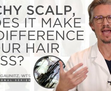Does an Itchy Scalp have an impact on hair loss? Dandruff, Seborrheic Dermatitis, and Treatment