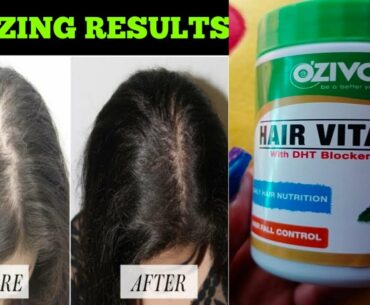 Control Hairfall With Oziva Hair Vitamins || Hair Vitamins For Hair Growth