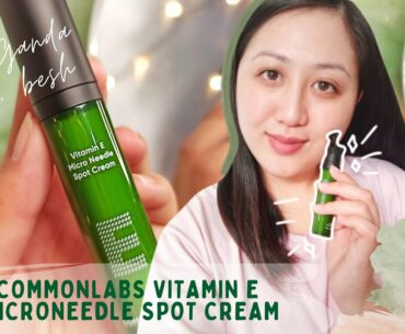 Commonlabs Vitamin E Microneedle Spot Cream | After 2 weeks! | Dawn Lyndelle Beauty