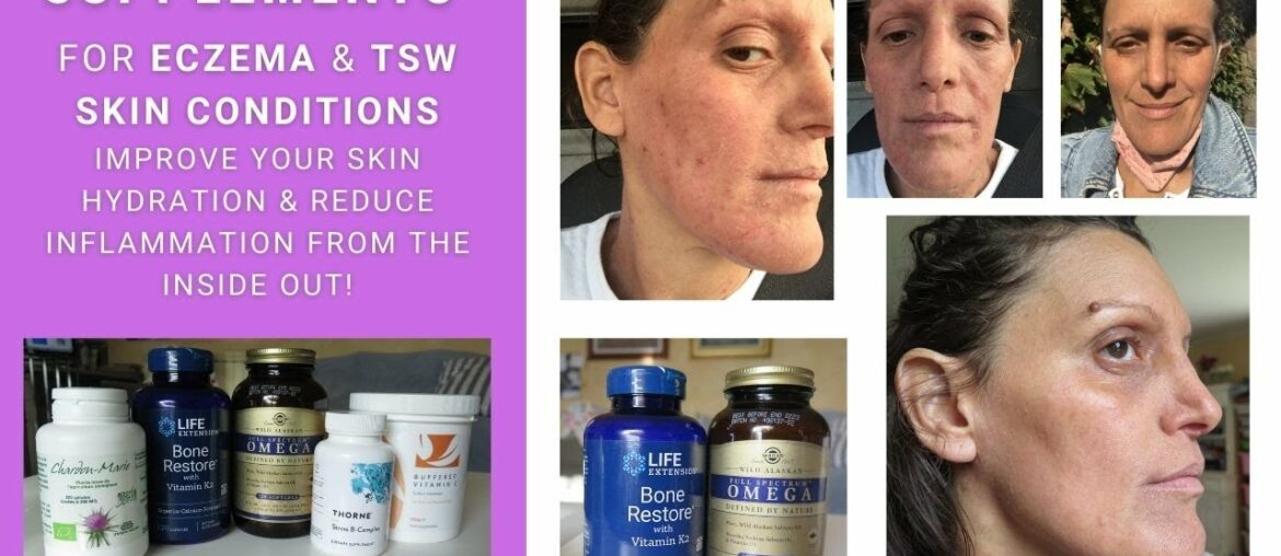 SUPPLEMENTS FOR ECZEMA & TSW SKIN CONDITIONS