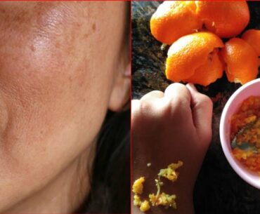 Vitamin-C Facial For Winter Skin Lightening and Glowing in 5 Minutes / High pigmentation ka ilaj