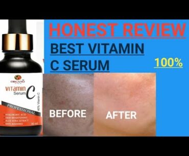 vitamin c serum organo gold review | organo gold vitamin c serum honest review | vitamin c serum