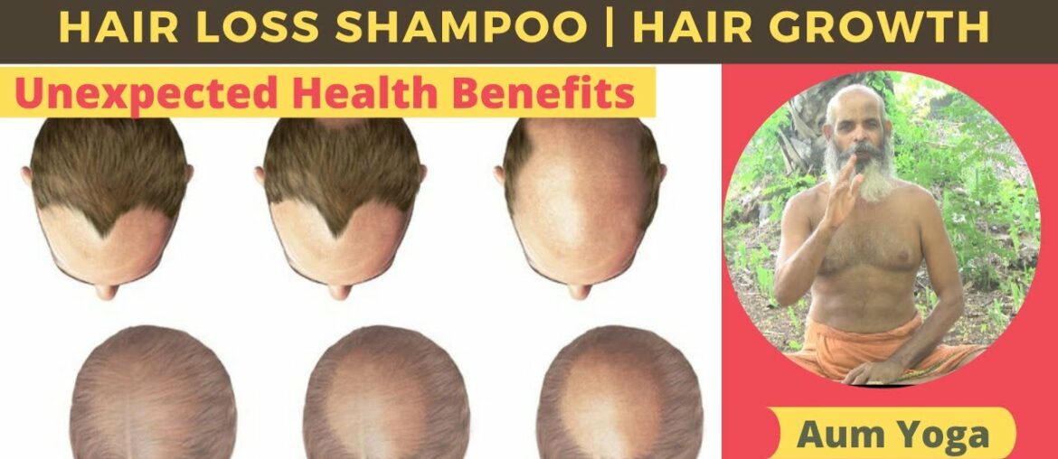 Hair loss shampoo | Hair growth | Baldhead | Hair loss men| ganja sar| Hair loss vitamins| hair fall