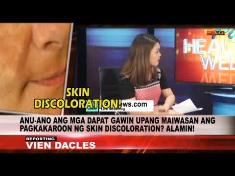 PINOY HEALTH AND WELLNESS: MGA PARAAN PARA MAIWASAN ANG SKIN DISCOLORATION