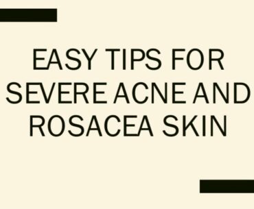Easy tips for severe acne and rosacea skin