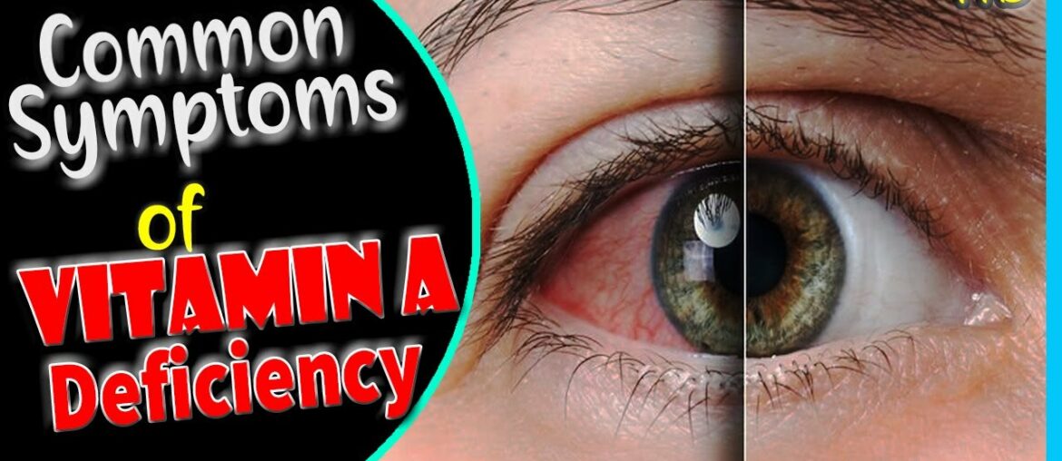 Signs of Vitamin A Deficiency