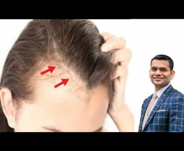 Hair fall? This Vitamin can Really Help You | Dr. Vivek Joshi