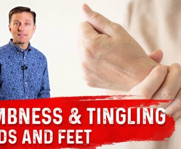 Benefits of Vitamin B - Numbness & Tingling In Hands & Feet - Dr.Berg