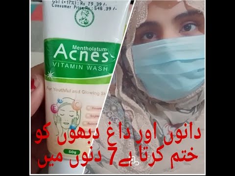 Pimple ko khatm kary acnes vitamins wash;kayni beauty tips;