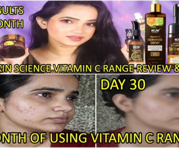 1 MONTH Of Using WOW Vitamin C Range Challenge (WOW vitamin C Facewash,Toner,Serum,moisturizer)