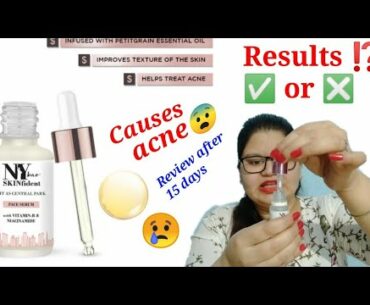 NY Bae vitamin B and niacinamide face serum review | For acne | Beauty Petals